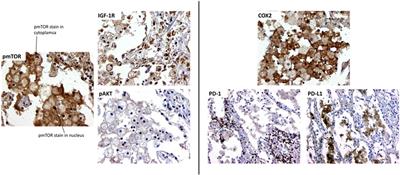 Morphoproteomic-Guided Host-Directed Therapy for Tuberculosis